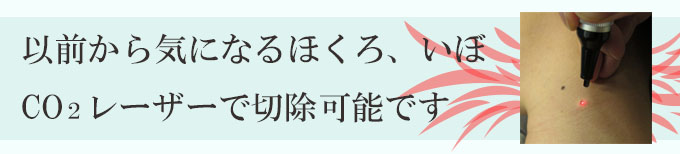 ほくろやいぼとりを美容皮膚科でレーザー治療、神奈川、横浜